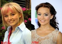 Angelique Boyer Nose Job Plastic Surgery Before And After Photos