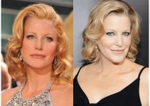 Anna Gunn Plastic Surgery Before And After Botox, Facelift Photos