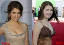 Anna Kendrick Plastic Surgery Before And After Photos
