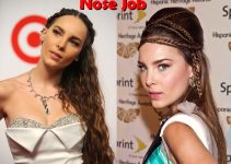 Belinda Peregrin Plastic Surgery Before And After Photos