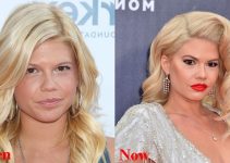 Chanel West Coast Plastic Surgery Before And After Photos 2023