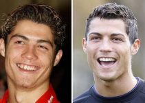 Cristiano Ronaldo Plastic Surgery Before And After Pictures 2022