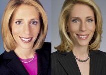 Dana Bash Plastic Surgery Before And After Photos 2023