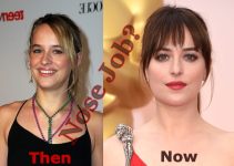Dakota Johnson Plastic Surgery Before And After Photo
