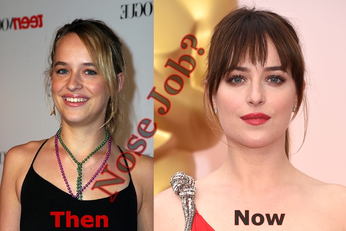 Dakota Johnson Plastic Surgery Before And After Photo