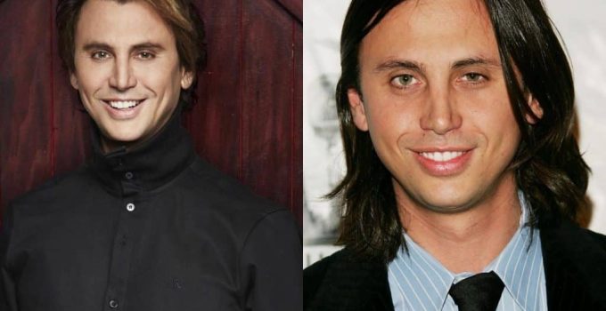 Jonathan Cheban Plastic Surgery Before And After Face Photos 2022
