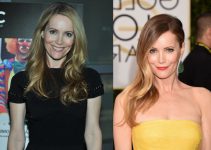 Leslie Mann Plastic Surgery Before And After Photos