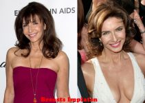 Mary Steenburgen Facelift Before And After Pictures