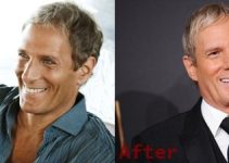 Michael Bolton Plastic Surgery Before and After Photos 2022