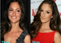 Minka Kelly plastic surgery Before And After Photos