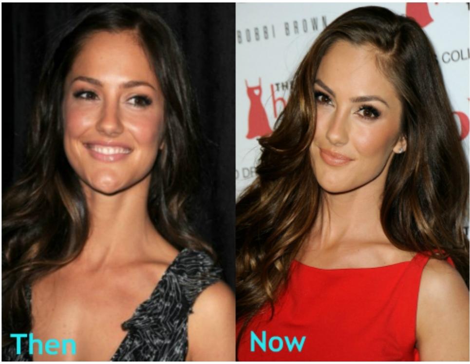 minka kelly before and after plastic surgery photos