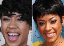Keyshia Cole Before and After Plastic Surgery Photos