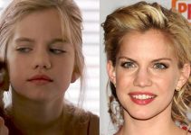 Anna Chlumsky Nose Job Plastic Surgery Before And After
