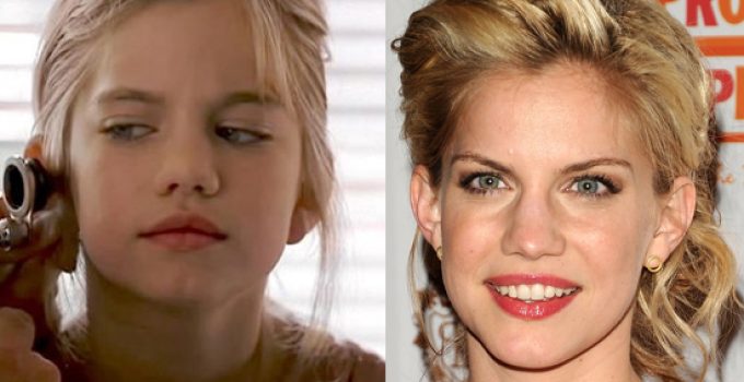 Anna Chlumsky Nose Job Plastic Surgery Before And After