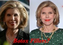 Christine Baranski Plastic Surgery Before And After Photos