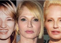 Ellen Barkin Plastic Surgery Before And After Pictures