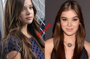 Keep on reading to get details about Hailee Steinfeld plastic surgery along with her before and after photos.