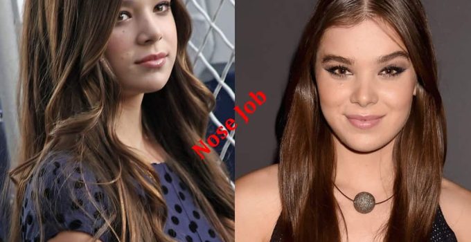 Hailee Steinfeld Plastic Surgery Before And After Photos