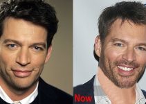 Harry Connick Jr Plastic Surgery Before And After Pictures