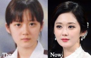 Jang Nara Plastic Surgery Before And After Facelift, Eyelid Photos