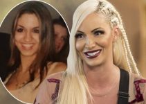 Jodie Marsh Plastic Surgery Before And After Photo