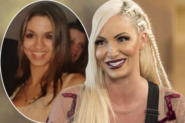 Jodie Marsh Plastic Surgery Before And After Photo