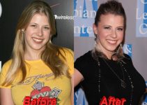 Jodie Sweetin Plastic Surgery Before And After Pictures