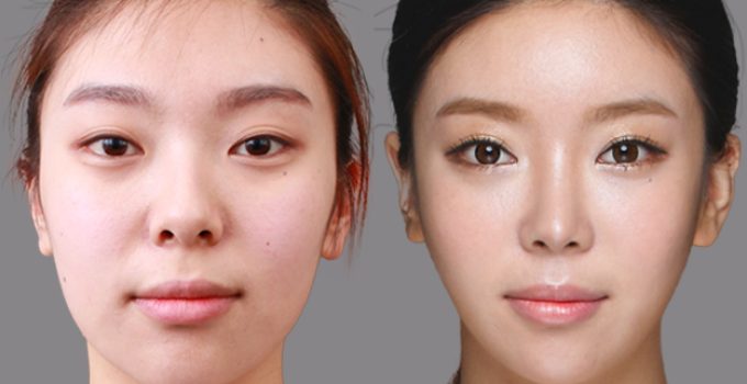 Lee Yu Bi Plastic Surgery Before And After Nose, Eyes Photos