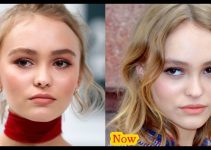 Lily Rose Depp Plastic Surgery Before And After Photos