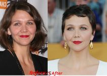 Maggie Gyllenhaal Plastic Surgery Before And After Photos