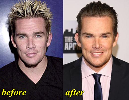 Mark McGrath Plastic Surgery Before And After Photos
