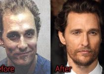 Matthew Mcconaughey Plastic Surgery Before And After Pictures