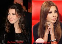 Nancy Ajram Plastic Surgery Before And After Photos