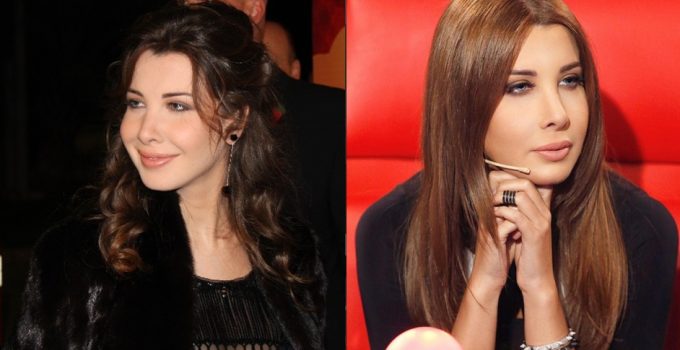 Nancy Ajram Plastic Surgery Before And After Photos