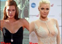 Sophie Monk Plastic Surgery Before And After Boobs Photos