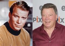 William Shatner Plastic Surgery Before And After Pictures