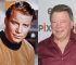 William Shatner Plastic Surgery Before And After Pictures