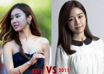 Yoo In Na Plastic Surgery Before And After Photos, Pictures