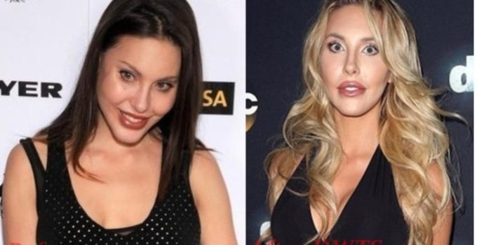Chloe Lattanzi Plastic Surgery Before And After Photos