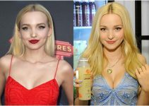 Dove Cameron Before and After Plastic Surgery Photos