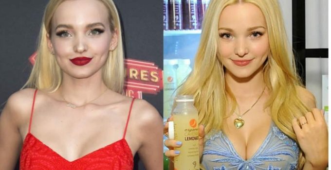 Dove Cameron Before and After Plastic Surgery Photos