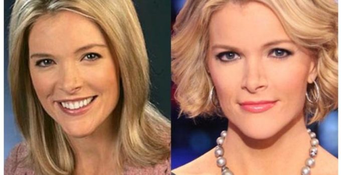 Megyn Kelly Plastic Surgery Before And After Breast, Nose Job Photos