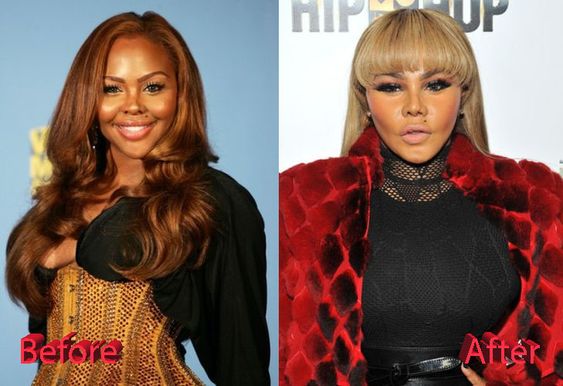 before and after lil kim